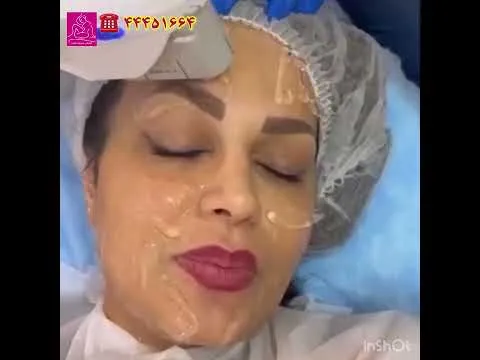 بهترین دکتر هایفو نی نی سایت