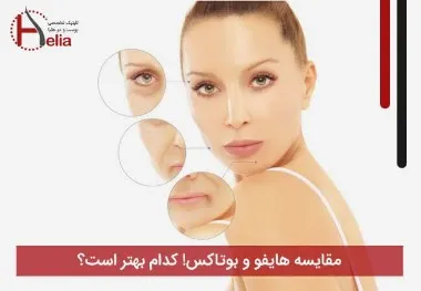 آر اف بهتر است یا هایفو